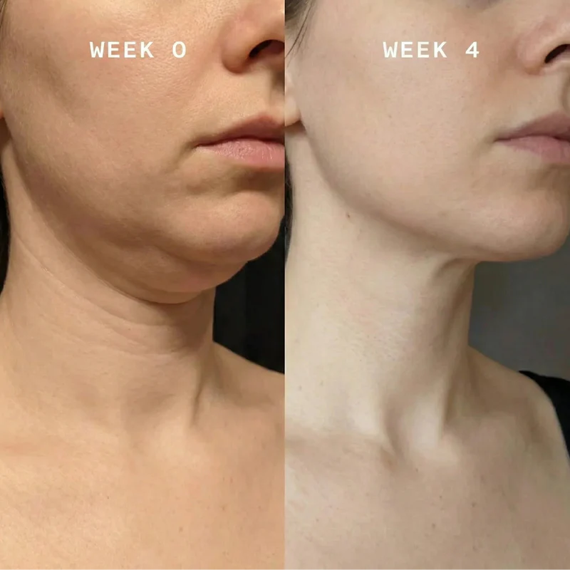 Suitable for All Skin Types