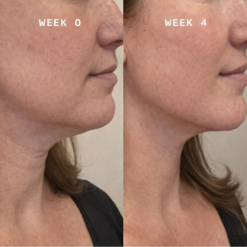 Clinic-Quality Results